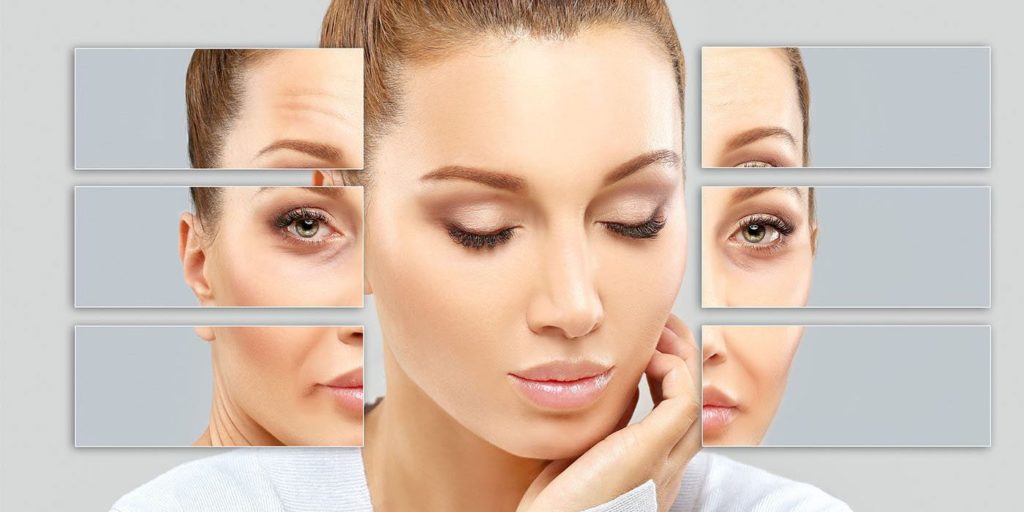 Ultherapy (Ameliyatsız Yüz Germe)